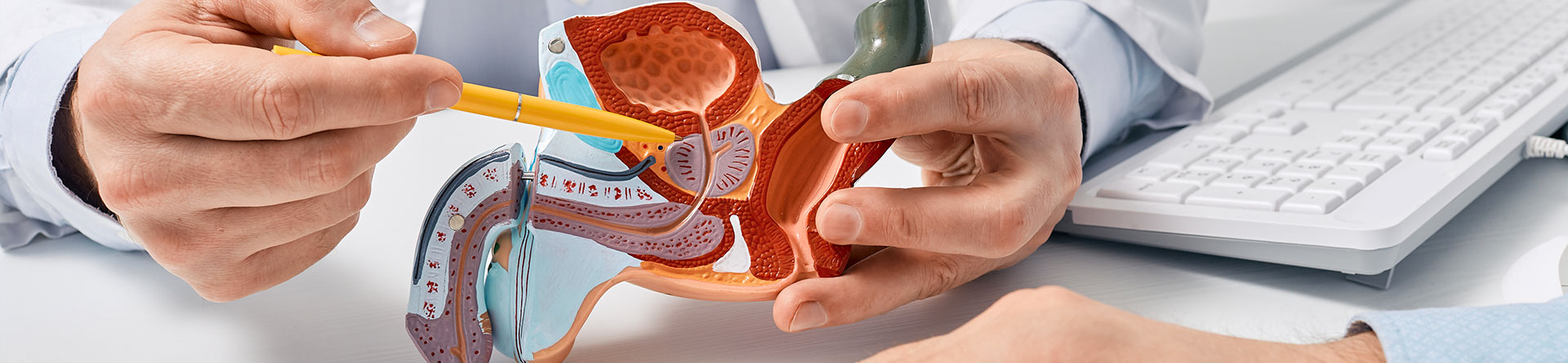 Embolisation des artères prostatiques